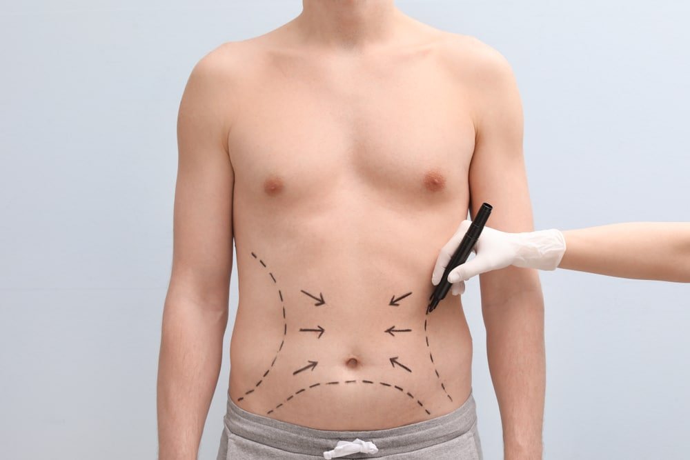 body contouring surgery in delhi